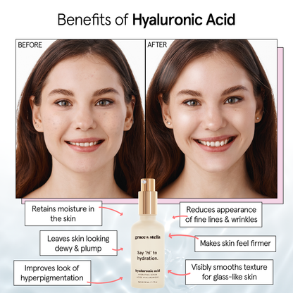 Hyaluronic Acid Serum: 50 mL (1.7 fl oz)