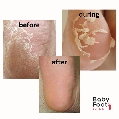 Baby Foot 30 Minute Express Exfoliation Foot Peel